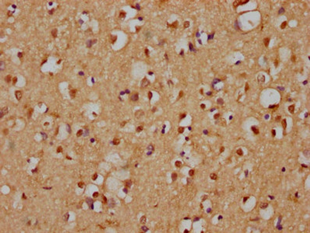 IHC image of CSB-PA803130LA01HU diluted at 1:200 and staining in paraffin-embedded human brain tissue performed on a Leica BondTM system. After dewaxing and hydration, antigen retrieval was mediated by high pressure in a citrate buffer (pH 6.0). Section was blocked with 10% normal goat serum 30min at RT. Then primary antibody (1% BSA) was incubated at 4°C overnight. The primary is detected by a biotinylated secondary antibody and visualized using an HRP conjugated SP system.