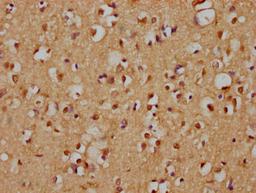 IHC image of CSB-PA803130LA01HU diluted at 1:200 and staining in paraffin-embedded human brain tissue performed on a Leica BondTM system. After dewaxing and hydration, antigen retrieval was mediated by high pressure in a citrate buffer (pH 6.0). Section was blocked with 10% normal goat serum 30min at RT. Then primary antibody (1% BSA) was incubated at 4°C overnight. The primary is detected by a biotinylated secondary antibody and visualized using an HRP conjugated SP system.