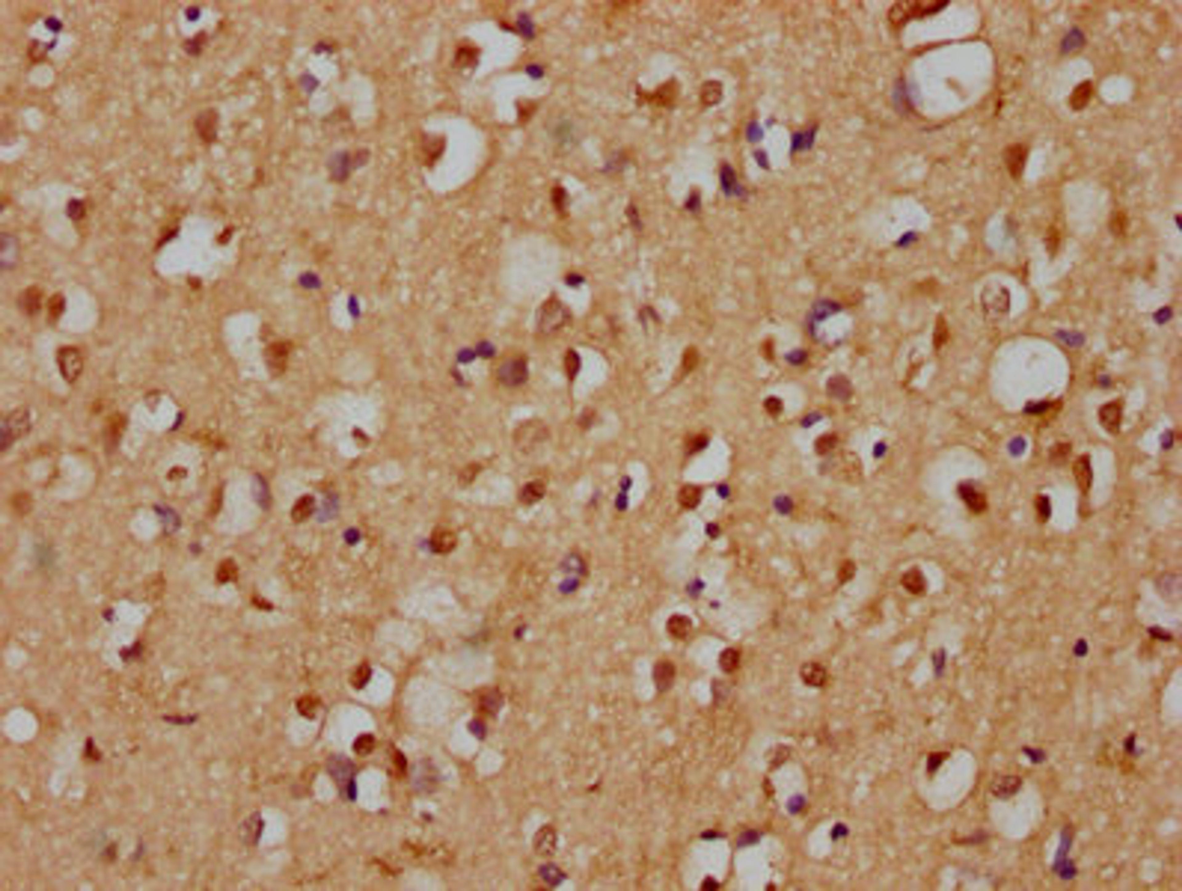 IHC image of CSB-PA803130LA01HU diluted at 1:200 and staining in paraffin-embedded human brain tissue performed on a Leica BondTM system. After dewaxing and hydration, antigen retrieval was mediated by high pressure in a citrate buffer (pH 6.0). Section was blocked with 10% normal goat serum 30min at RT. Then primary antibody (1% BSA) was incubated at 4°C overnight. The primary is detected by a biotinylated secondary antibody and visualized using an HRP conjugated SP system.