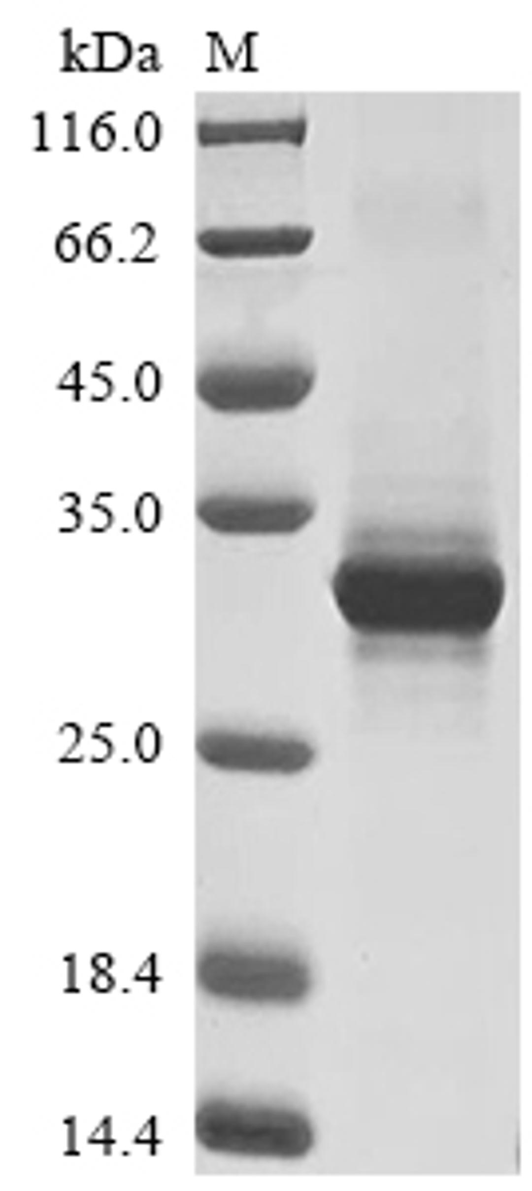 (Tris-Glycine gel) Discontinuous SDS-PAGE (reduced) with 5% enrichment gel and 15% separation gel.