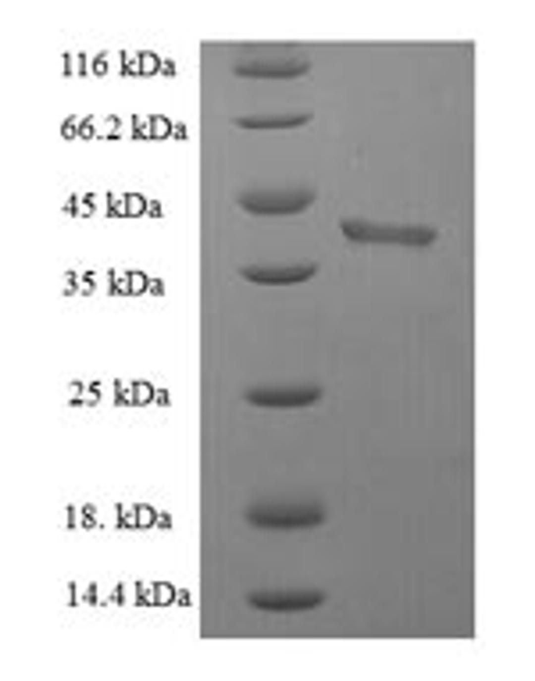 (Tris-Glycine gel) Discontinuous SDS-PAGE (reduced) with 5% enrichment gel and 15% separation gel.