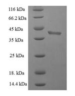 (Tris-Glycine gel) Discontinuous SDS-PAGE (reduced) with 5% enrichment gel and 15% separation gel.