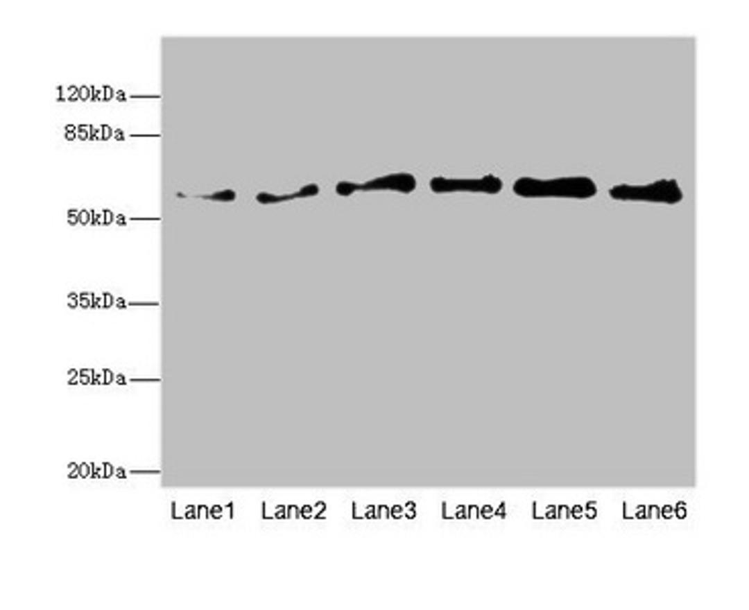 Western blot. All lanes: PIP5K1B antibody at 5.46ug/ml. Lane 1: Human placenta tissue. Lane 2: Mouse kidney tissue. Lane 3: Mouse skeletal muscle tissue. Lane 4: Mouse heart tissue. Lane 5: Mouse brain tissue. Lane 6: Mouse lung tissue. Secondary. Goat polyclonal to rabbit IgG at 1/10000 dilution. Predicted band size: 62, 63, 57 kDa. Observed band size: 62 kDa. 