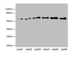 Western blot. All lanes: PIP5K1B antibody at 5.46ug/ml. Lane 1: Human placenta tissue. Lane 2: Mouse kidney tissue. Lane 3: Mouse skeletal muscle tissue. Lane 4: Mouse heart tissue. Lane 5: Mouse brain tissue. Lane 6: Mouse lung tissue. Secondary. Goat polyclonal to rabbit IgG at 1/10000 dilution. Predicted band size: 62, 63, 57 kDa. Observed band size: 62 kDa. 