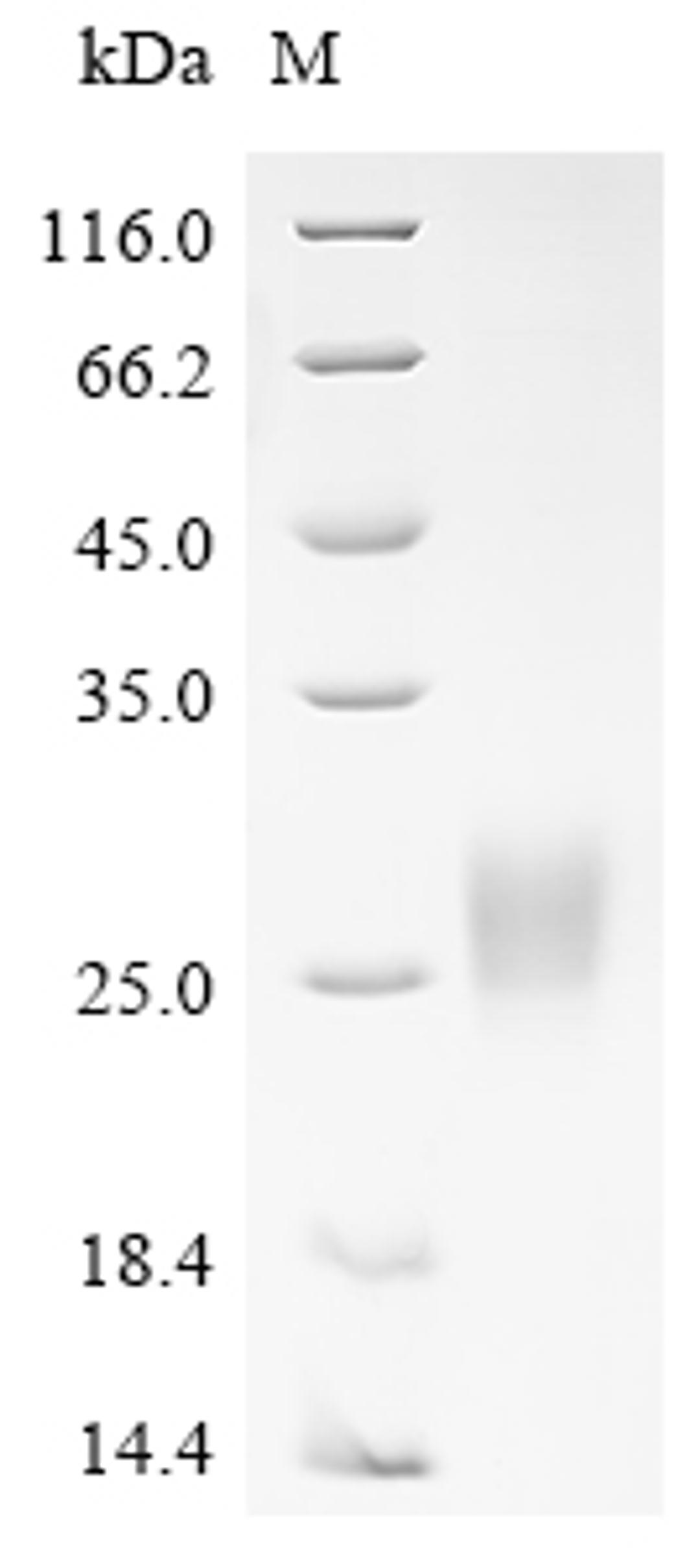 (Tris-Glycine gel) Discontinuous SDS-PAGE (reduced) with 5% enrichment gel and 15% separation gel.