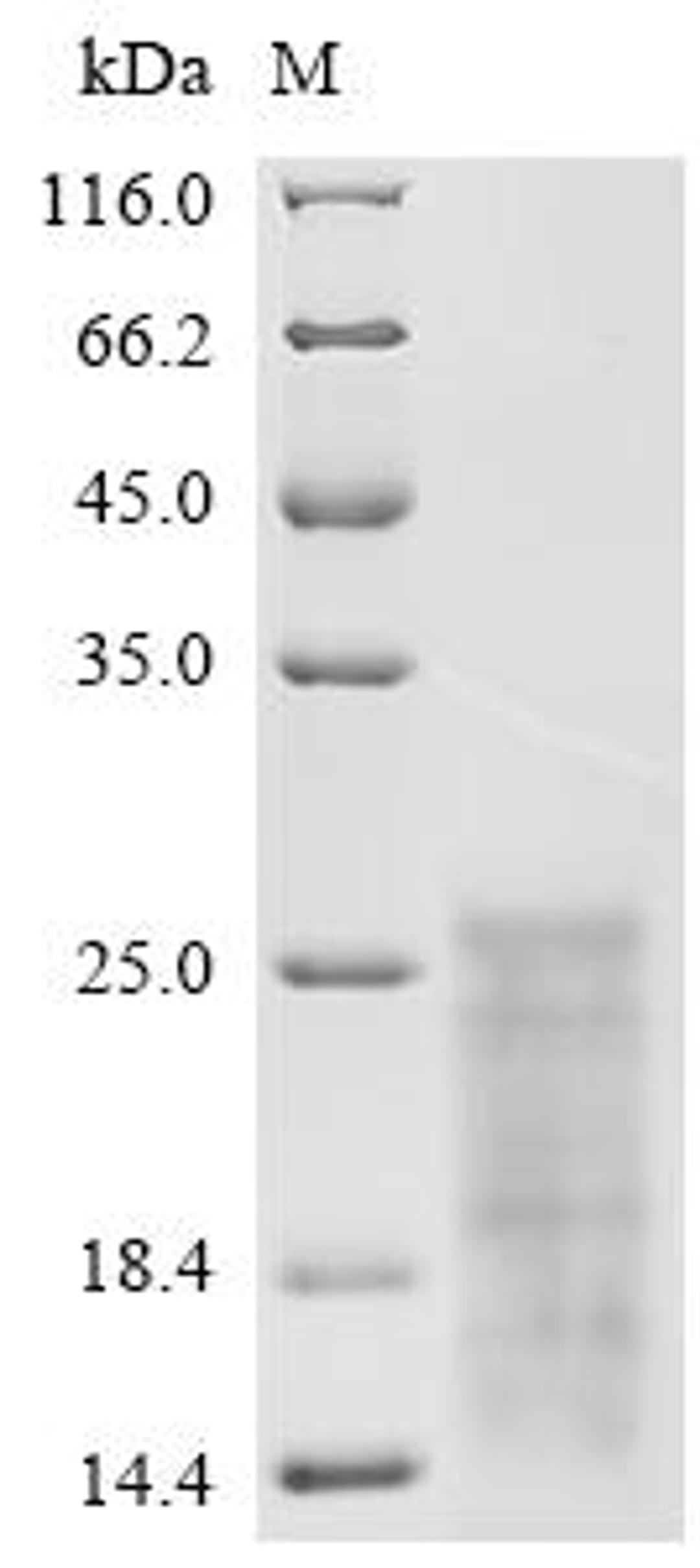 (Tris-Glycine gel) Discontinuous SDS-PAGE (reduced) with 5% enrichment gel and 15% separation gel.