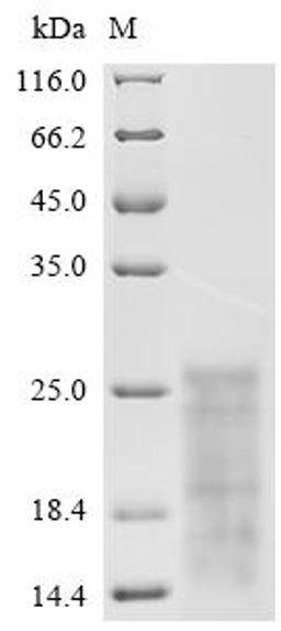 (Tris-Glycine gel) Discontinuous SDS-PAGE (reduced) with 5% enrichment gel and 15% separation gel.