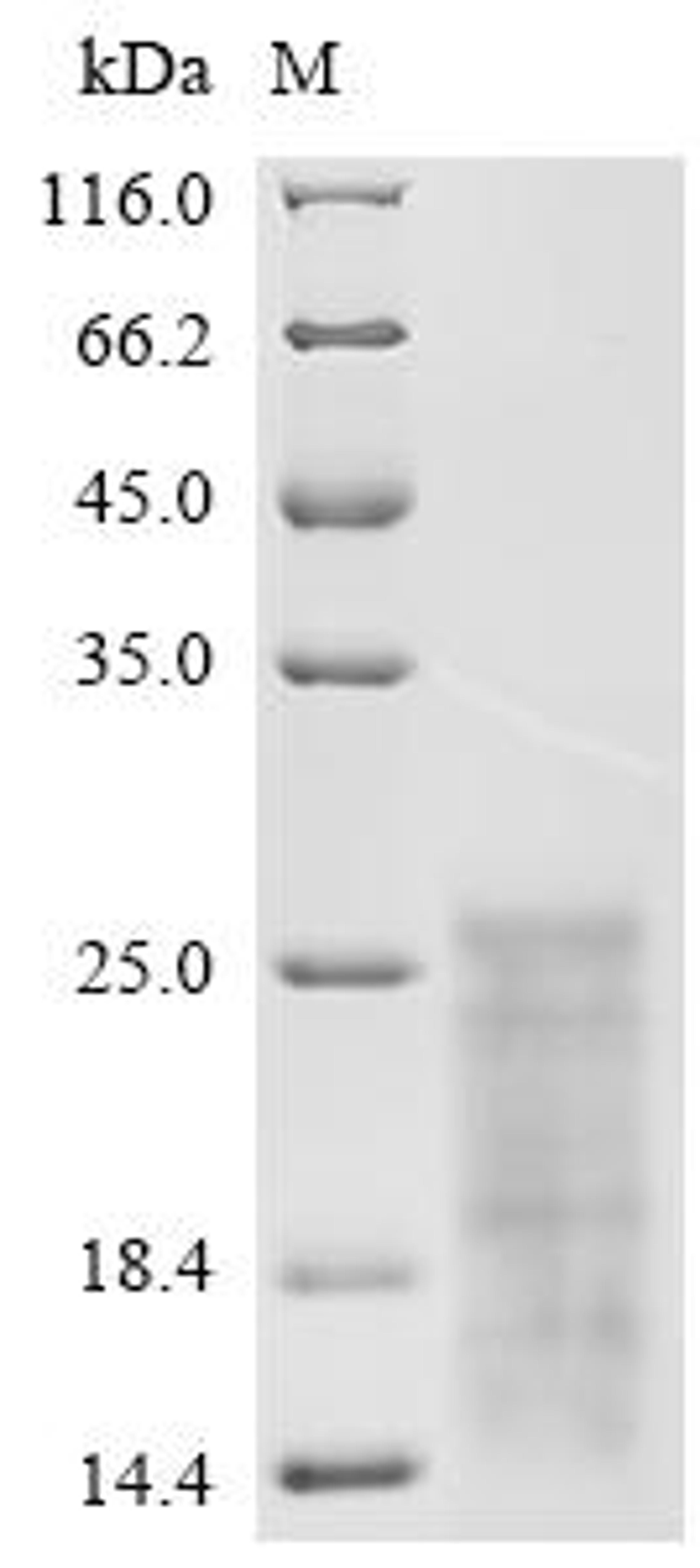 (Tris-Glycine gel) Discontinuous SDS-PAGE (reduced) with 5% enrichment gel and 15% separation gel.