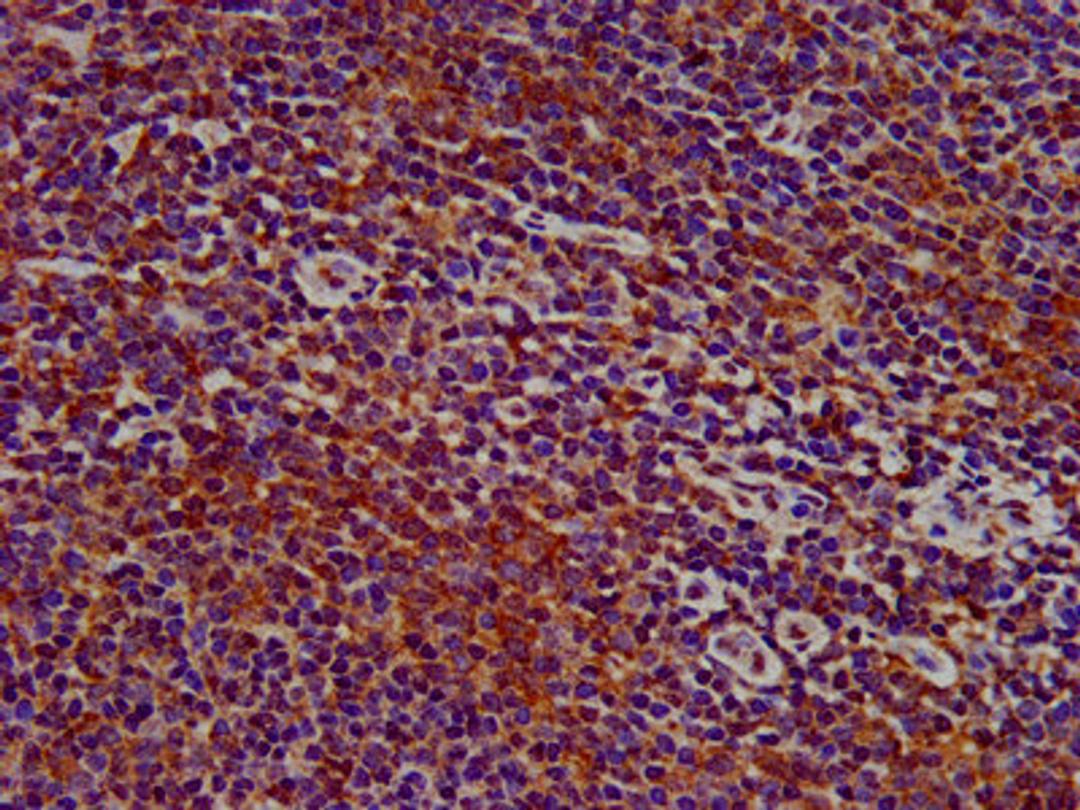 IHC image of CSB-PA842706LA01HU diluted at 1:400 and staining in paraffin-embedded human lymph node tissue performed on a Leica BondTM system. After dewaxing and hydration, antigen retrieval was mediated by high pressure in a citrate buffer (pH 6.0). Section was blocked with 10% normal goat serum 30min at RT. Then primary antibody (1% BSA) was incubated at 4&deg;C overnight. The primary is detected by a biotinylated secondary antibody and visualized using an HRP conjugated SP system.