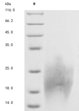 (Tris-Glycine gel) Discontinuous SDS-PAGE (reduced) with 5% enrichment gel and 15% separation gel.