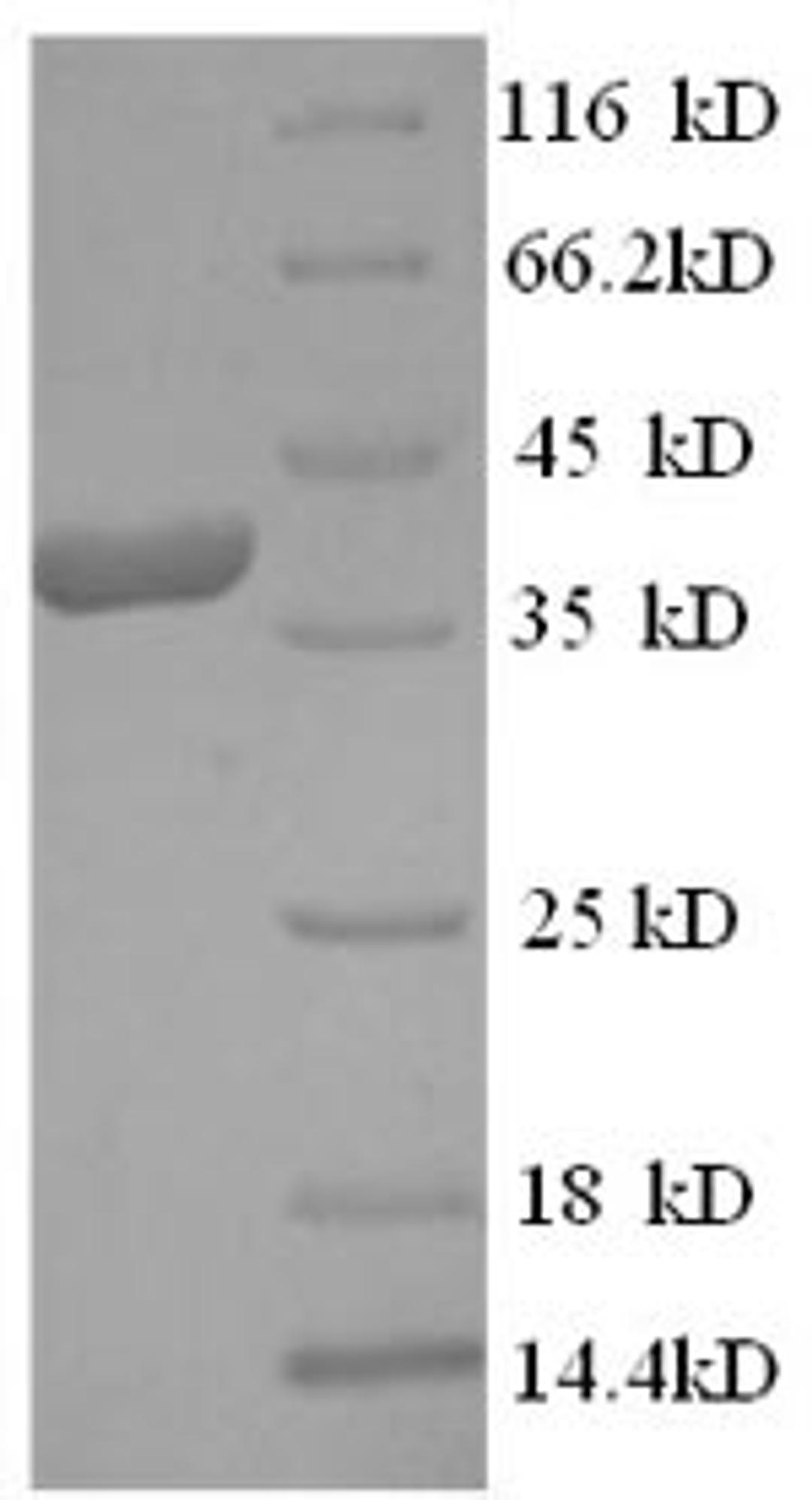 (Tris-Glycine gel) Discontinuous SDS-PAGE (reduced) with 5% enrichment gel and 15% separation gel.