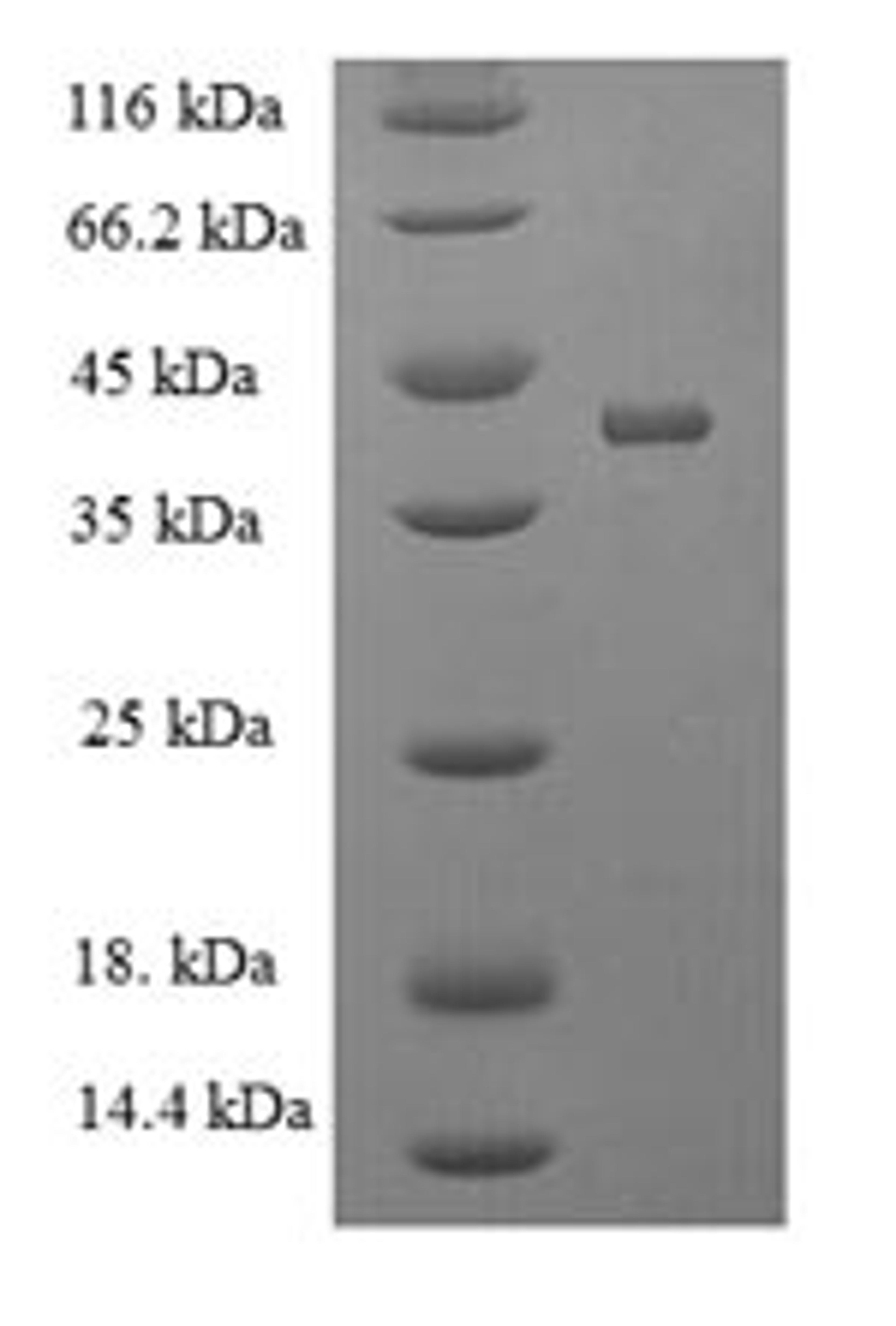(Tris-Glycine gel) Discontinuous SDS-PAGE (reduced) with 5% enrichment gel and 15% separation gel.