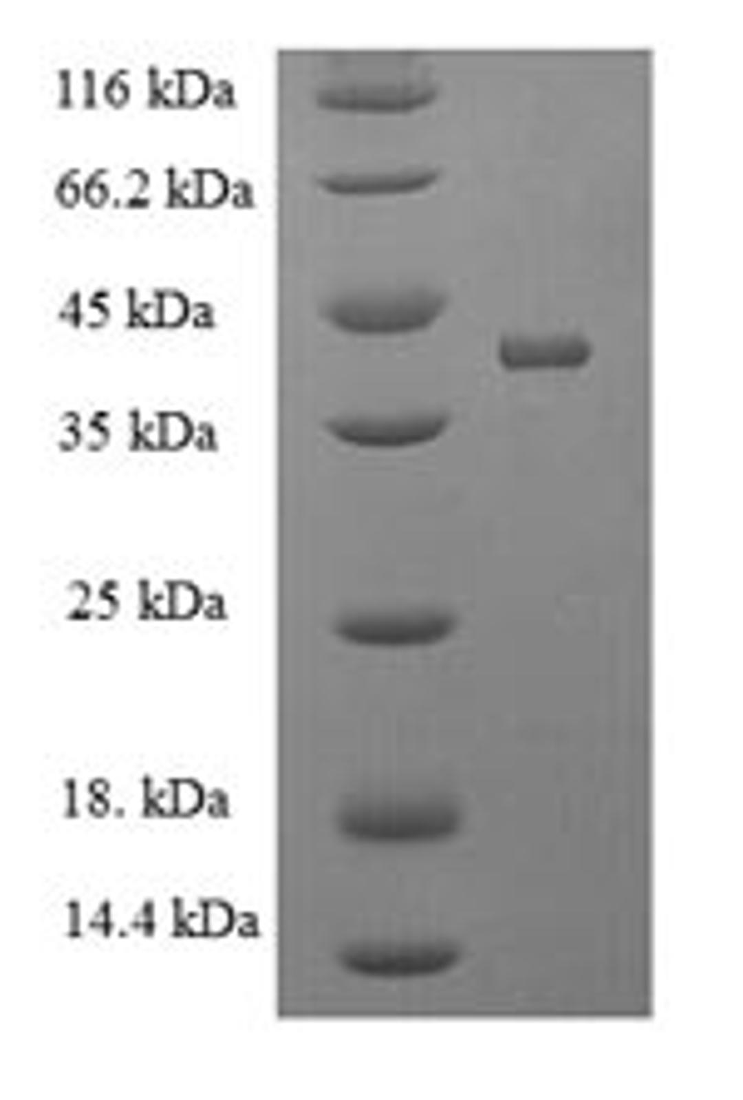 (Tris-Glycine gel) Discontinuous SDS-PAGE (reduced) with 5% enrichment gel and 15% separation gel.