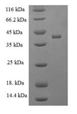 (Tris-Glycine gel) Discontinuous SDS-PAGE (reduced) with 5% enrichment gel and 15% separation gel.