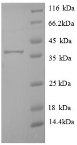 (Tris-Glycine gel) Discontinuous SDS-PAGE (reduced) with 5% enrichment gel and 15% separation gel.
