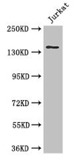 Western Blot. Positive WB detected in: Jurkat whole cell lysate. All lanes: ATXN2 antibody at 3µg/ml. Secondary. Goat polyclonal to rabbit IgG at 1/50000 dilution. Predicted band size: 141, 107, 28, 133, 110 kDa. Observed band size: 141 kDa