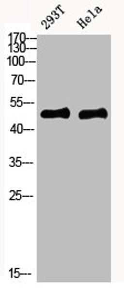 Western blot analysis of mouse-kidney mouse-brain mouse-lung mouse-heart 293T lysate, antibody was diluted at 1000. Secondary antibody  was diluted at 1:20000