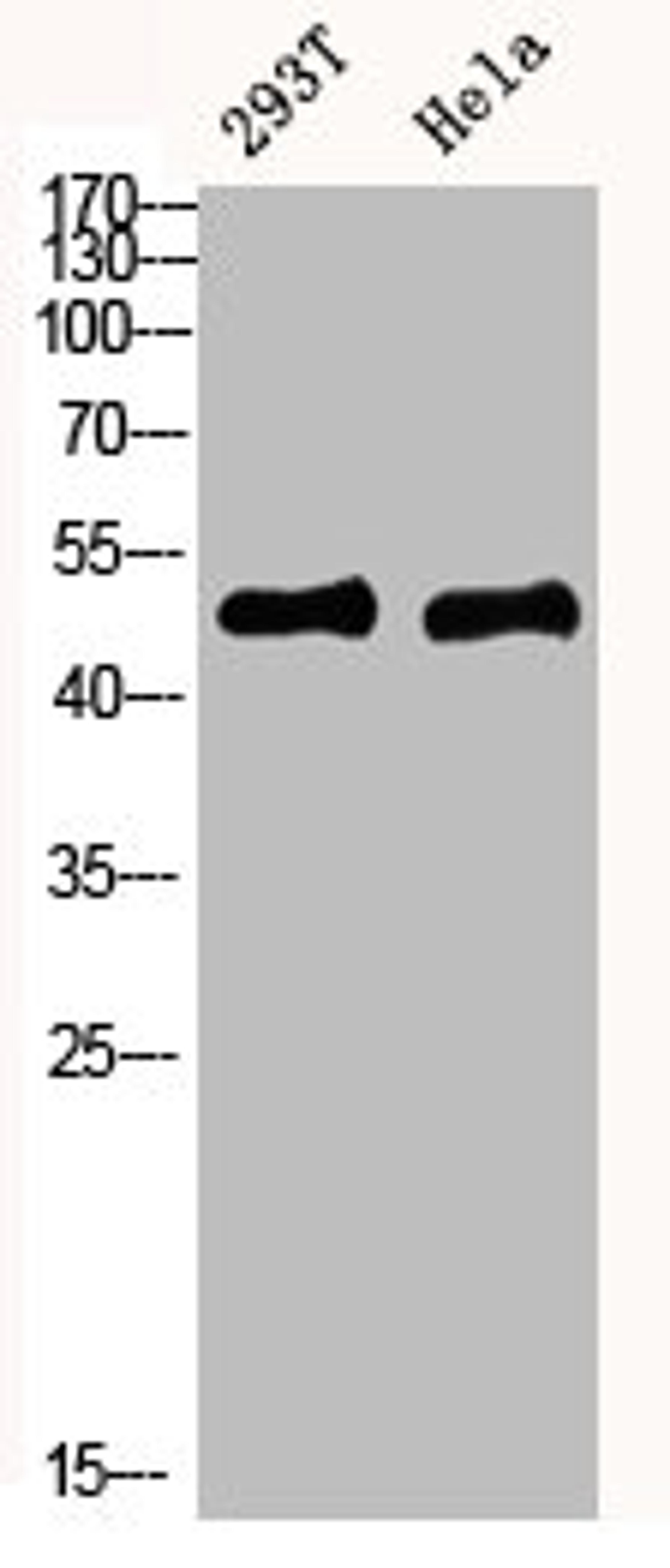 Western blot analysis of mouse-kidney mouse-brain mouse-lung mouse-heart 293T lysate, antibody was diluted at 1000. Secondary antibody  was diluted at 1:20000