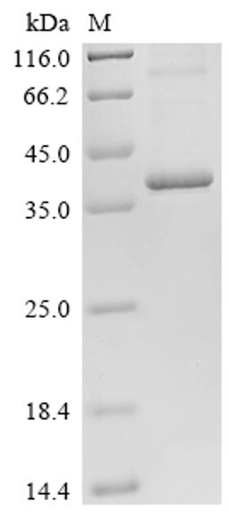 (Tris-Glycine gel) Discontinuous SDS-PAGE (reduced) with 5% enrichment gel and 15% separation gel.