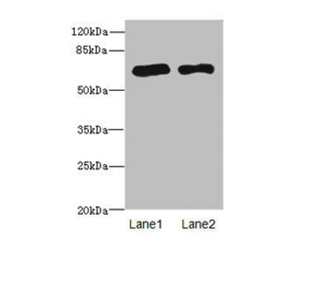 Western blot. All lanes: PPM1Dantibody at 2.36ug/ml. Lane 1: Rat gonadal tissue. Lane 2: U87 whole cell lysate. Secondary. Goat polyclonal to rabbit IgG at 1/10000 dilution. Predicted band size: 67, 48 kDa. Observed band size: 67 kDa. 