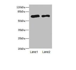 Western blot. All lanes: PPM1Dantibody at 2.36ug/ml. Lane 1: Rat gonadal tissue. Lane 2: U87 whole cell lysate. Secondary. Goat polyclonal to rabbit IgG at 1/10000 dilution. Predicted band size: 67, 48 kDa. Observed band size: 67 kDa. 