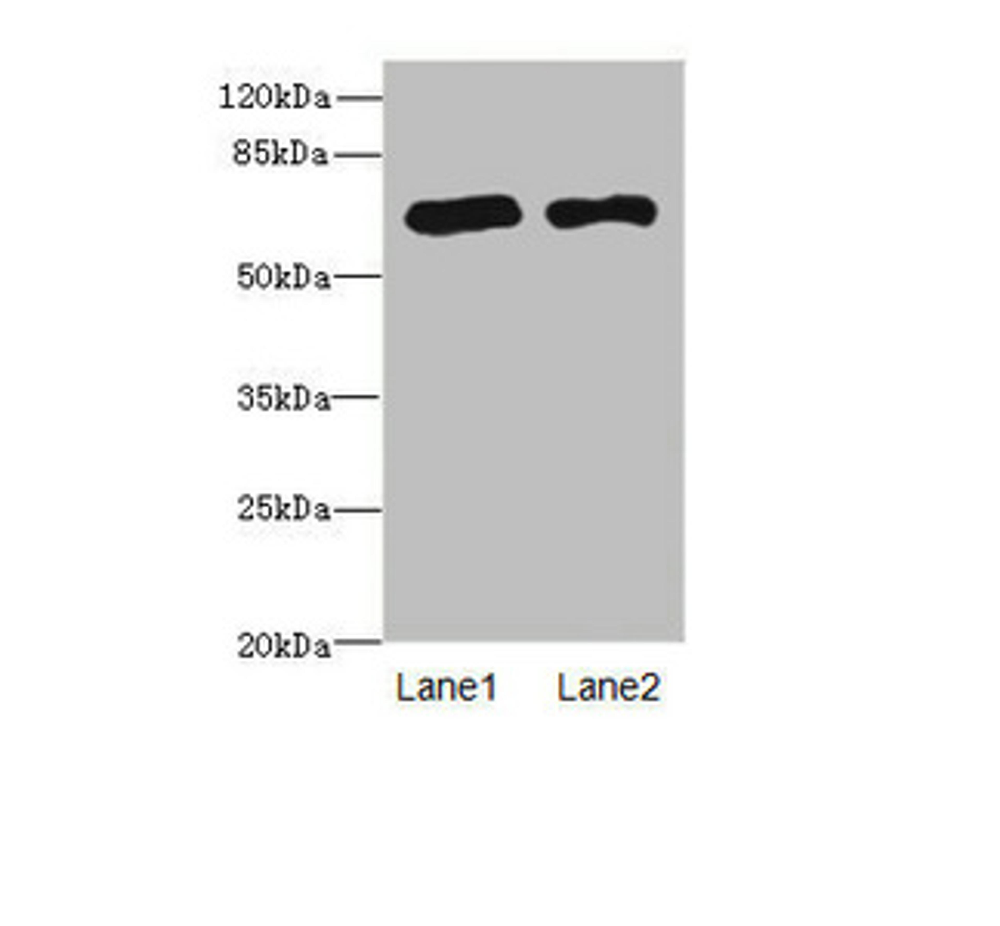 Western blot. All lanes: PPM1Dantibody at 2.36ug/ml. Lane 1: Rat gonadal tissue. Lane 2: U87 whole cell lysate. Secondary. Goat polyclonal to rabbit IgG at 1/10000 dilution. Predicted band size: 67, 48 kDa. Observed band size: 67 kDa. 