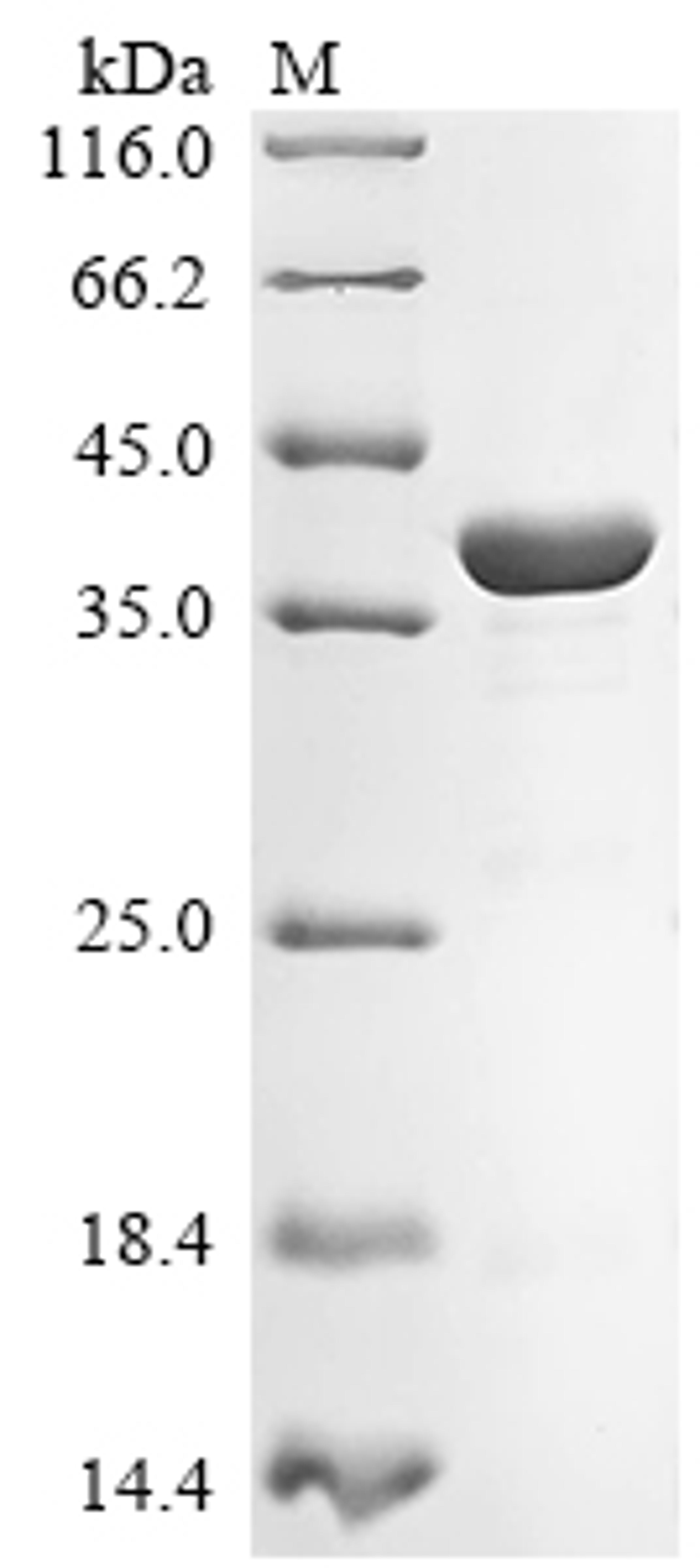 (Tris-Glycine gel) Discontinuous SDS-PAGE (reduced) with 5% enrichment gel and 15% separation gel.