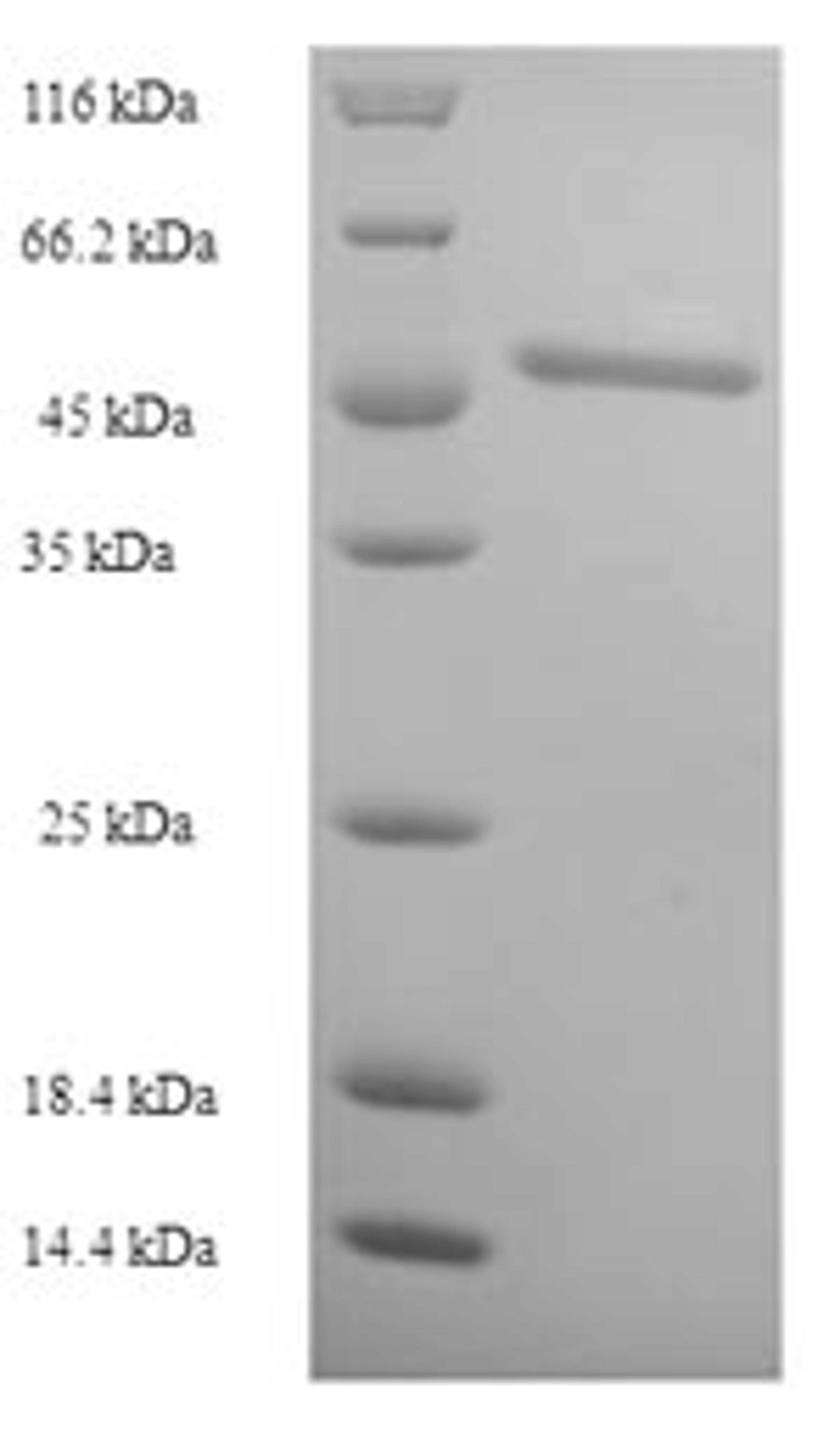 (Tris-Glycine gel) Discontinuous SDS-PAGE (reduced) with 5% enrichment gel and 15% separation gel.