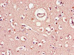 Immunohistochemistry of paraffin-embedded human brain tissue using CSB-PA450719LA01HU at dilution of 1:100