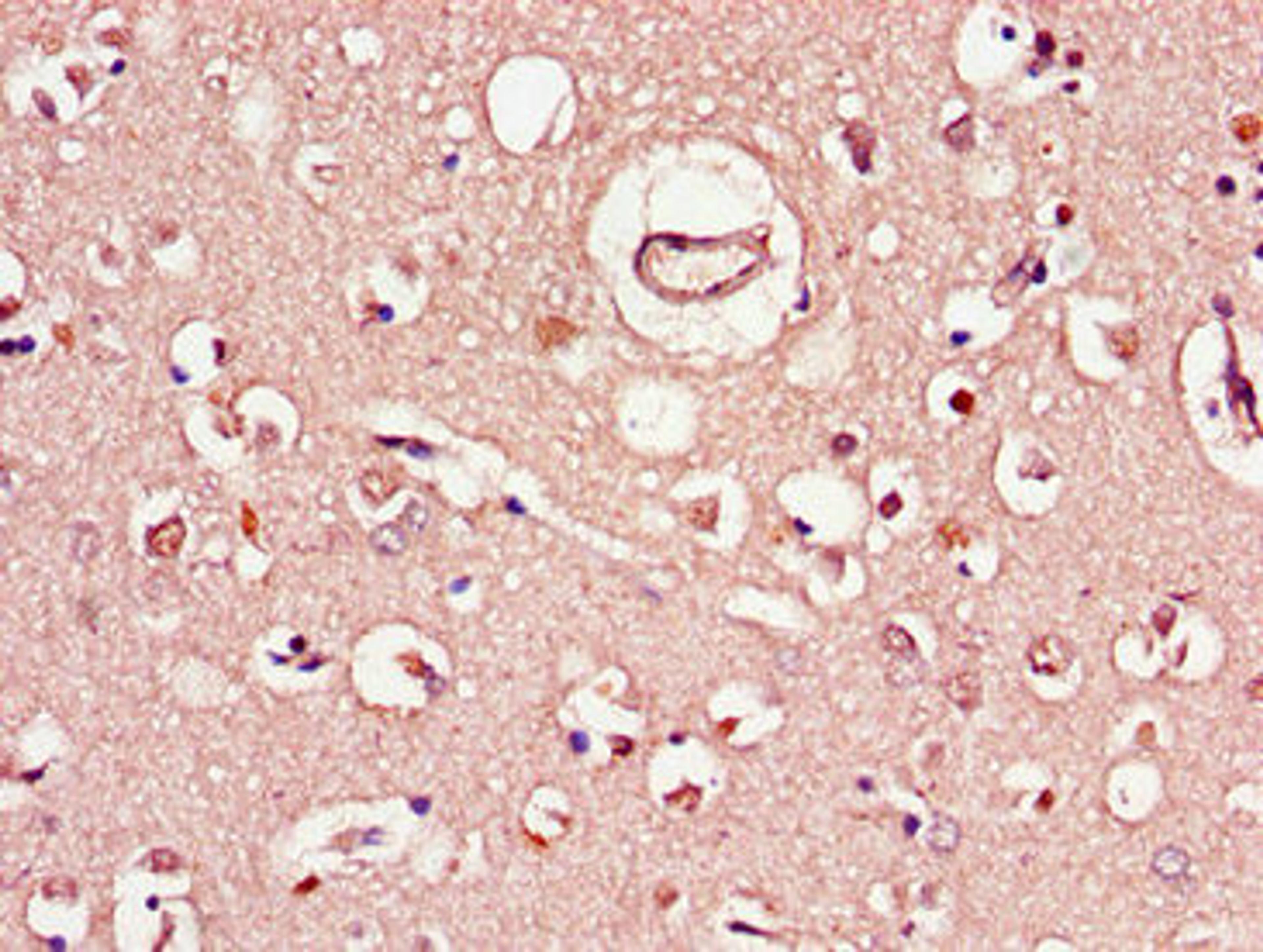 Immunohistochemistry of paraffin-embedded human brain tissue using CSB-PA450719LA01HU at dilution of 1:100