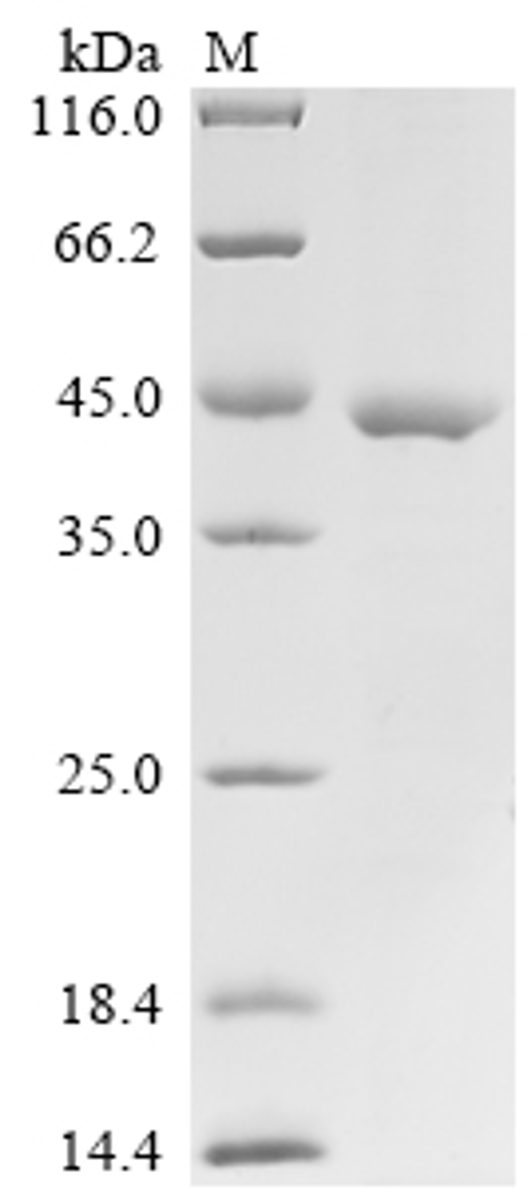 (Tris-Glycine gel) Discontinuous SDS-PAGE (reduced) with 5% enrichment gel and 15% separation gel.