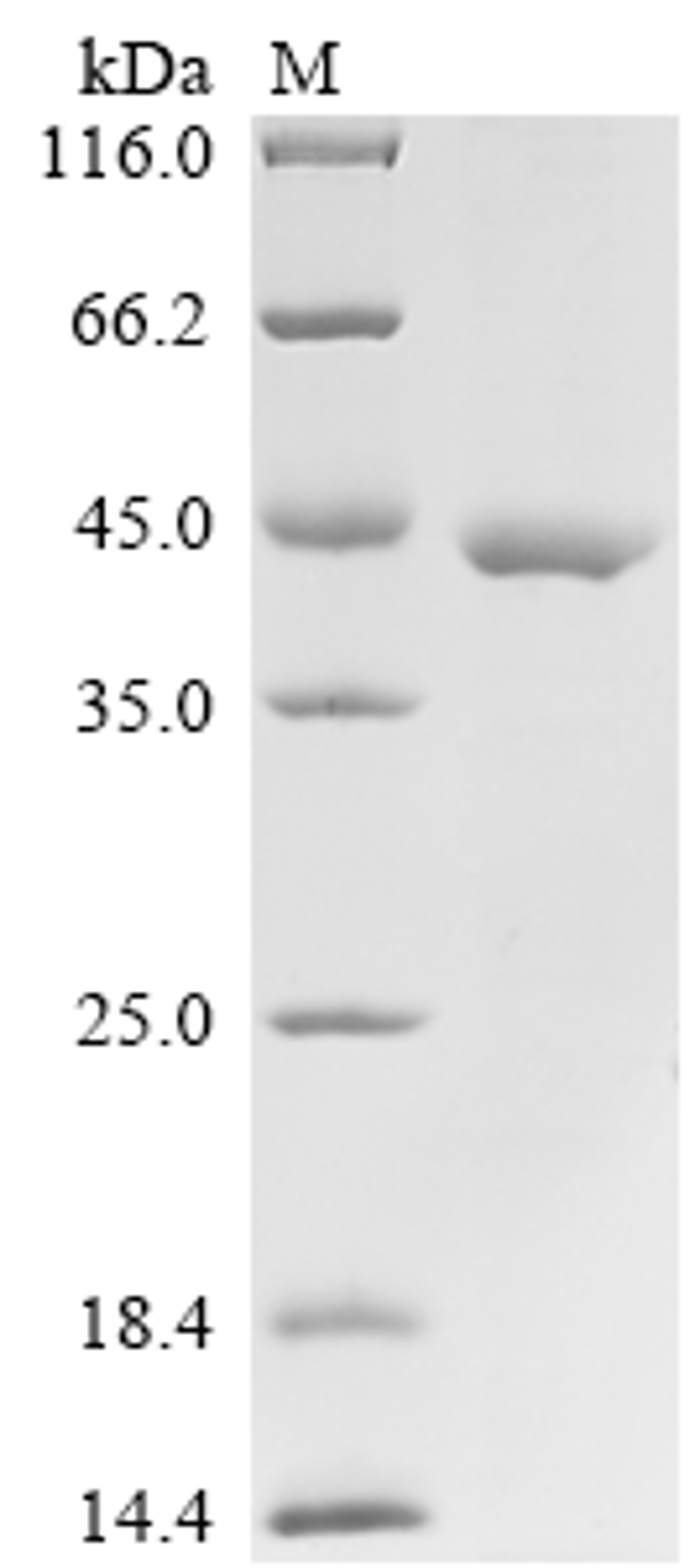 (Tris-Glycine gel) Discontinuous SDS-PAGE (reduced) with 5% enrichment gel and 15% separation gel.