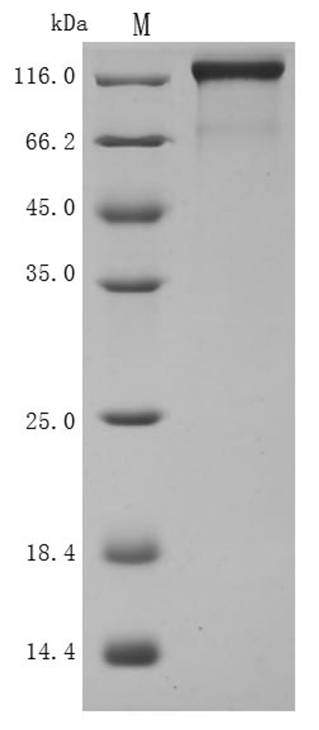 (Tris-Glycine gel) Discontinuous SDS-PAGE (reduced) with 5% enrichment gel and 15% separation gel.