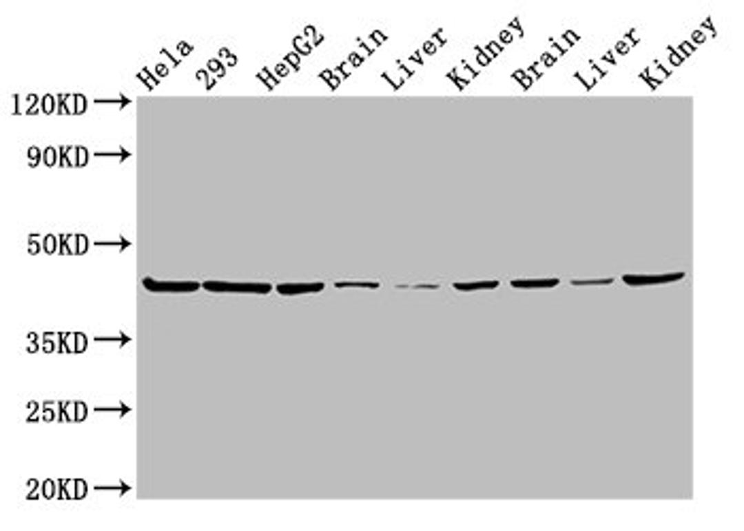 Western Blot. Positive WB detected in: Hela whole cell lysate, 293 whole cell lysate, HepG2 whole cell lysate, Mouse brain tissue, Mouse liver tissue, Mouse kidney tissue, Rat brain tissue, Rat liver tissue, Rat kidney tissue. All lanes: PSMC6 antibody at 3µg/ml. Secondary. Goat polyclonal to rabbit IgG at 1/50000 dilution. Predicted band size: 45 kDa. Observed band size: 45 kDa