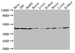 Western Blot. Positive WB detected in: Hela whole cell lysate, 293 whole cell lysate, HepG2 whole cell lysate, Mouse brain tissue, Mouse liver tissue, Mouse kidney tissue, Rat brain tissue, Rat liver tissue, Rat kidney tissue. All lanes: PSMC6 antibody at 3µg/ml. Secondary. Goat polyclonal to rabbit IgG at 1/50000 dilution. Predicted band size: 45 kDa. Observed band size: 45 kDa