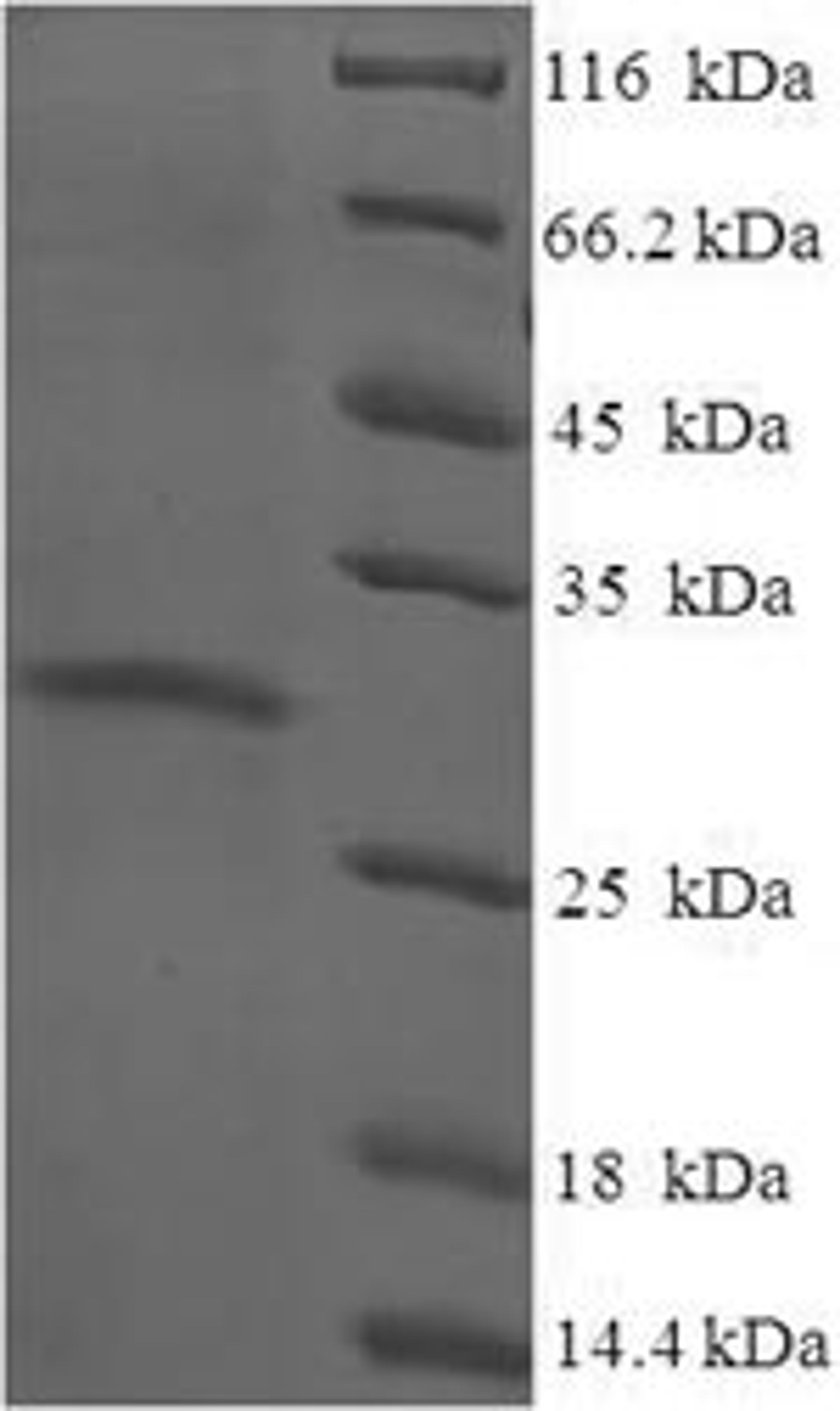 (Tris-Glycine gel) Discontinuous SDS-PAGE (reduced) with 5% enrichment gel and 15% separation gel.