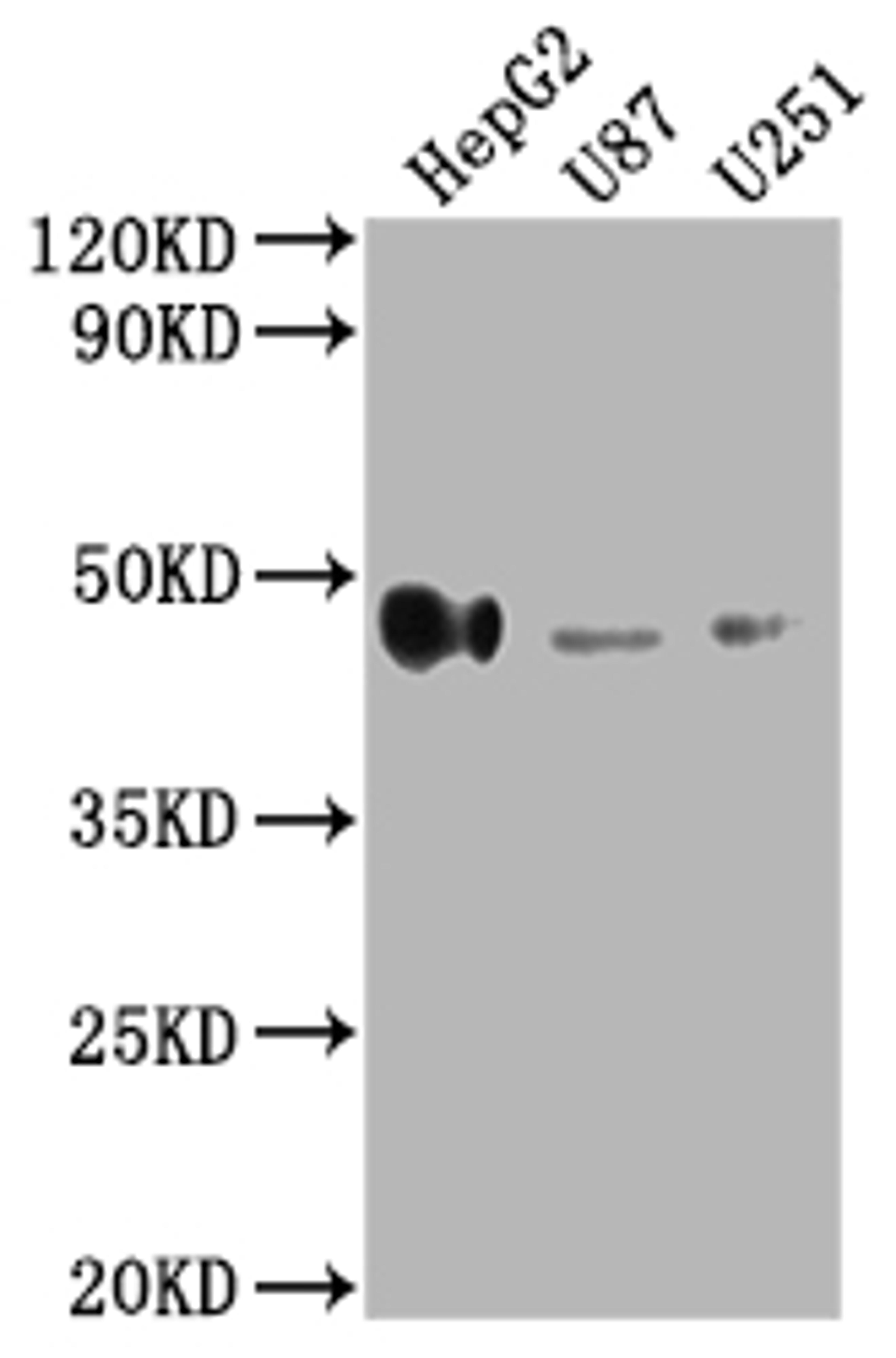 Western Blot. Positive WB detected in: HepG2 whole cell lysate, U87 whole cell lysate, U251 whole cell lysate. All lanes: HLA-G antibody at 1:2000. Secondary. Goat polyclonal to rabbit IgG at 1/50000 dilution. Predicted band size: 39, 28, 18, 37, 26, 14 kDa. Observed band size: 45 kDa. 