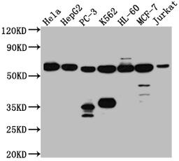 Western Blot. Positive WB detected in: Hela whole cell lysate, HepG2 whole cell lysate, PC-3 whole cell lysate, K562 whole cell lysate, HL-60 whole cell lysate, MCF-7 whole cell lysate, Jurkat whole cell lysate. All lanes: PTBP1 antibody at 1:1000. Secondary. Goat polyclonal to rabbit IgG at 1/50000 dilution. Predicted band size: 58, 60, 60 kDa. Observed band size: 58 kDa. 
