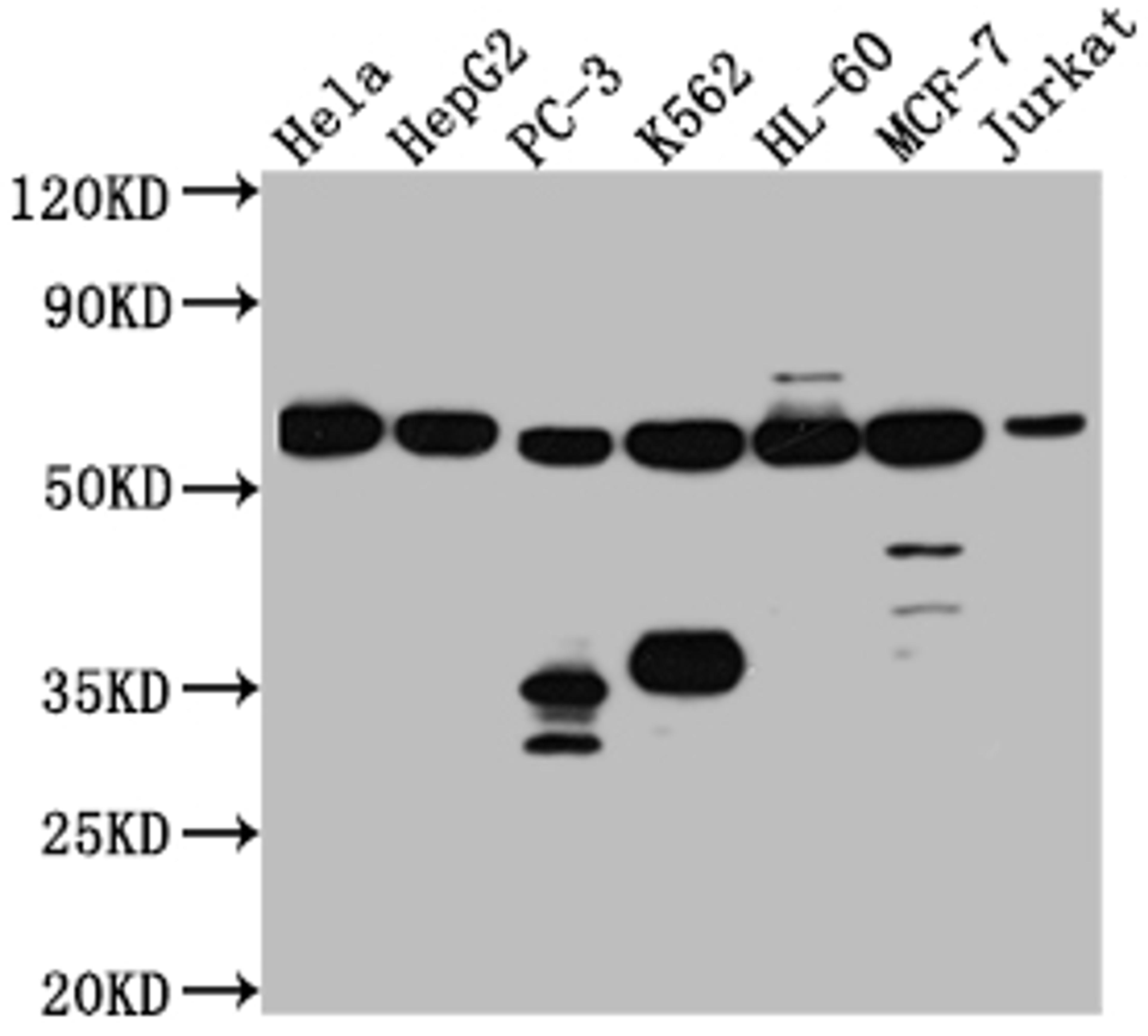 Western Blot. Positive WB detected in: Hela whole cell lysate, HepG2 whole cell lysate, PC-3 whole cell lysate, K562 whole cell lysate, HL-60 whole cell lysate, MCF-7 whole cell lysate, Jurkat whole cell lysate. All lanes: PTBP1 antibody at 1:1000. Secondary. Goat polyclonal to rabbit IgG at 1/50000 dilution. Predicted band size: 58, 60, 60 kDa. Observed band size: 58 kDa. 