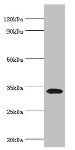 Western blot. All lanes: Low density lipoprotein receptor adapter protein 1 antibody at 4ug/ml + Mouse liver tissue. Secondary. Goat polyclonal to rabbit IgG at 1/10000 dilution. Predicted band size: 34 kDa. Observed band size: 34 kDa. 