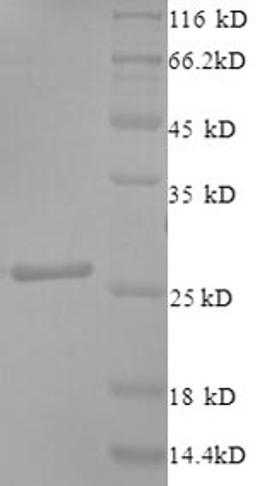 (Tris-Glycine gel) Discontinuous SDS-PAGE (reduced) with 5% enrichment gel and 15% separation gel.