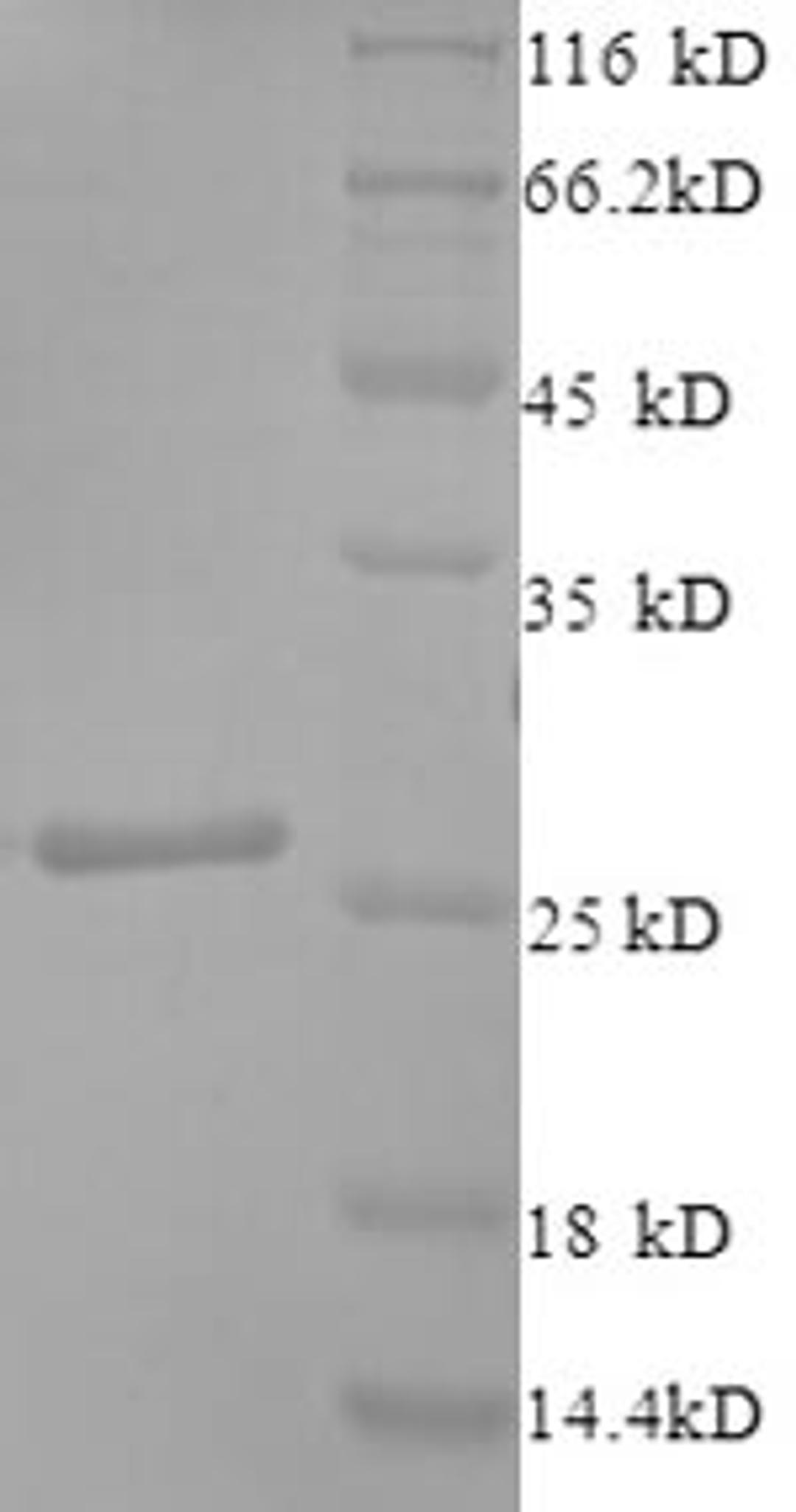 (Tris-Glycine gel) Discontinuous SDS-PAGE (reduced) with 5% enrichment gel and 15% separation gel.