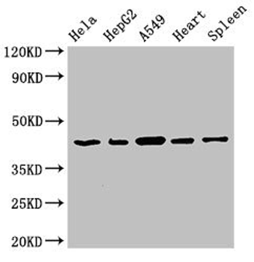 Western Blot. Positive WB detected in: Hela whole cell lysate, HepG2 whole cell lysate, A549 whole cell lysate, Rat heart tissue, Rat spleen tissue. All lanes: EIF3M antibody at 2.7µg/ml. Secondary. Goat polyclonal to rabbit IgG at 1/50000 dilution. Predicted band size: 43, 28 kDa. Observed band size: 43 kDa