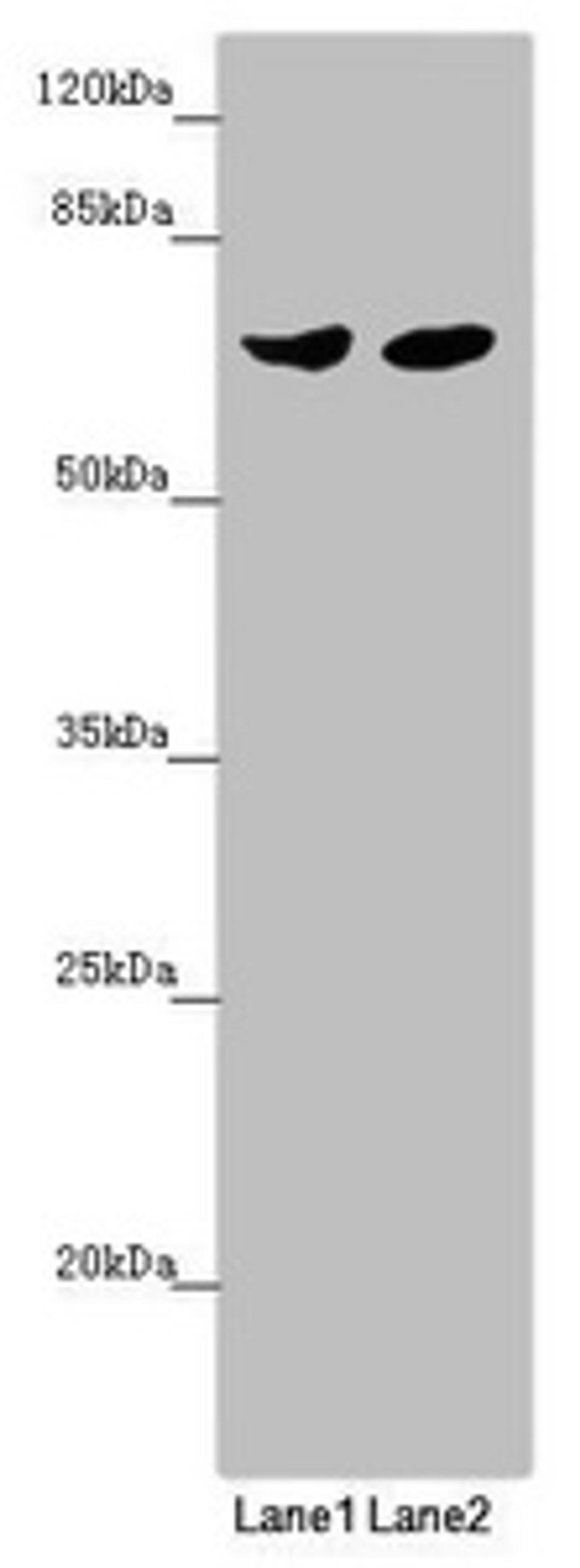 Western blot. All lanes: RARS2 antibody at 2.68 ug/ml. Lane 1: Mouse kidney tissue. Lane 2: HL60 whole cell lysate. Secondary. Goat polyclonal to rabbit IgG at 1/10000 dilution. Predicted band size: 66 kDa. Observed band size: 66 kDa. 