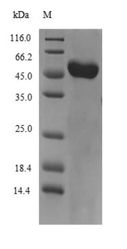 (Tris-Glycine gel) Discontinuous SDS-PAGE (reduced) with 5% enrichment gel and 15% separation gel.