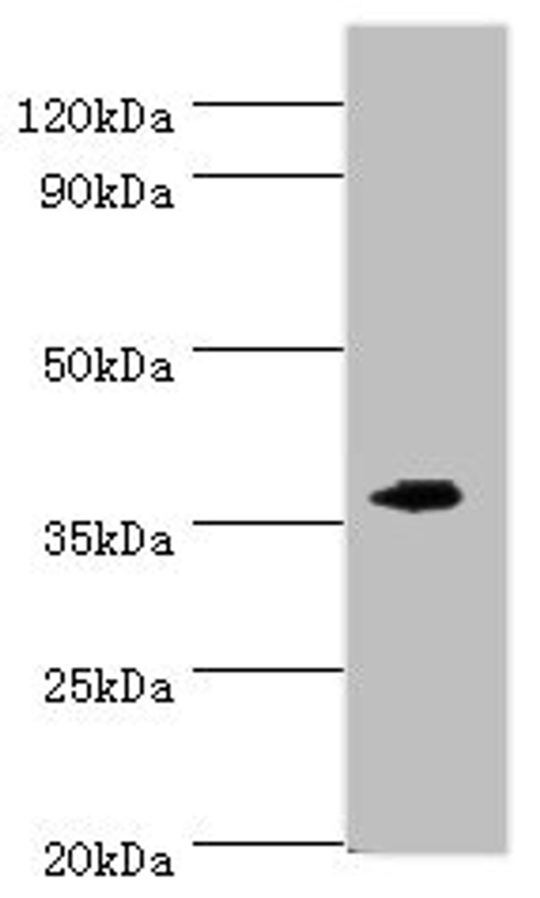 Western blot. All lanes: EFNB2 antibody at 6ug/ml + Mouse kidney tissue. Secondary. Goat polyclonal to rabbit IgG at 1/10000 dilution. Predicted band size: 37 kDa. Observed band size: 37 kDa. 