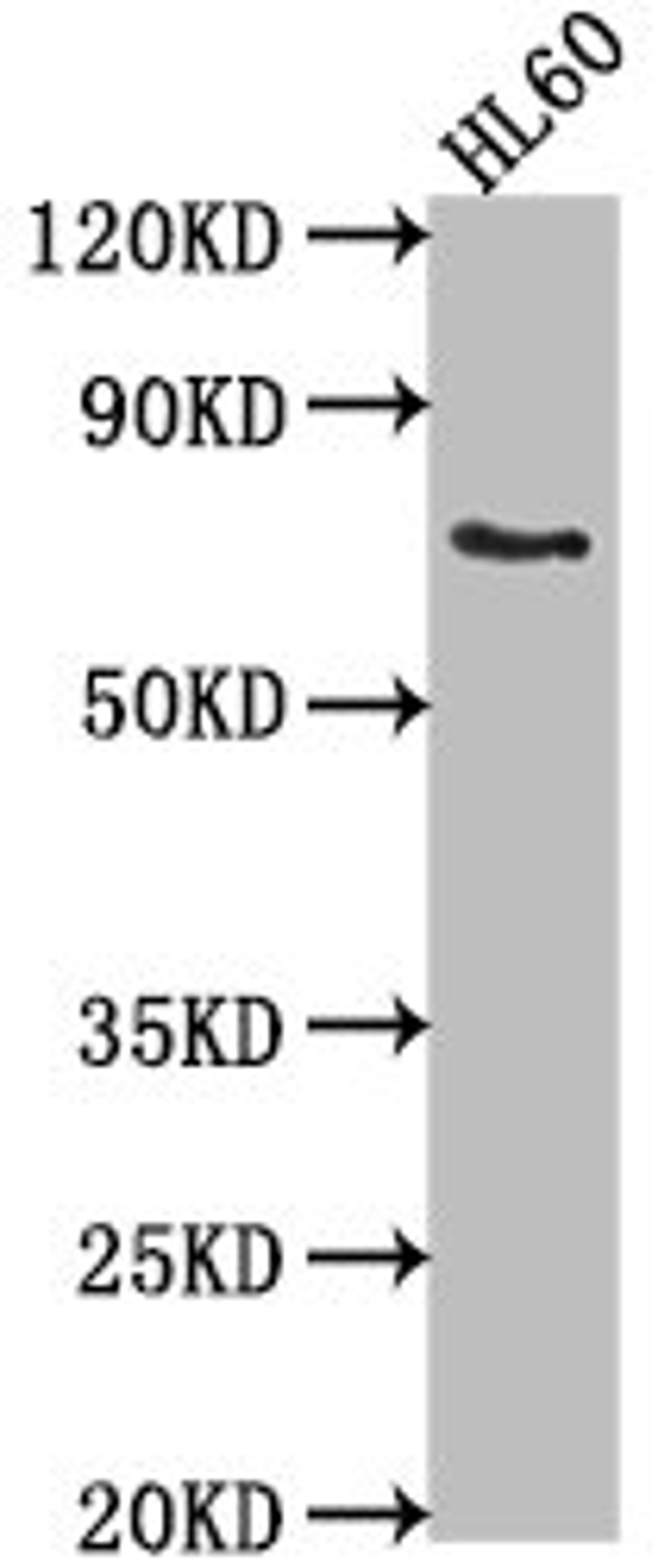 Western Blot. Positive WB detected in: HL60 whole cell lysate. All lanes: LRIT1 antibody at 1:2000. Secondary. Goat polyclonal to rabbit IgG at 1/50000 dilution. Predicted band size: 69 kDa. Observed band size: 69 kDa.