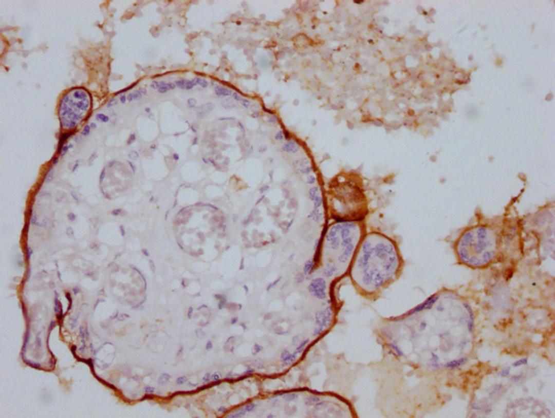 IHC image of CSB-MA294403 diluted at 1:100 and staining in paraffin-embedded human placenta tissue performed on a Leica BondTM system. After dewaxing and hydration, antigen retrieval was mediated by high pressure in a citrate buffer (pH 6.0). Section was blocked with 10% normal goat serum 30min at RT. Then primary antibody (1% BSA) was incubated at 4°C overnight. The primary is detected by a Goat anti-mouse IgG polymer labeled by HRP and visualized using 0.05% DAB.