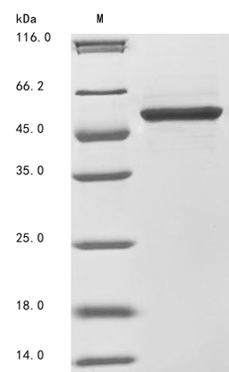 (Tris-Glycine gel) Discontinuous SDS-PAGE (reduced) with 5% enrichment gel and 15% separation gel.