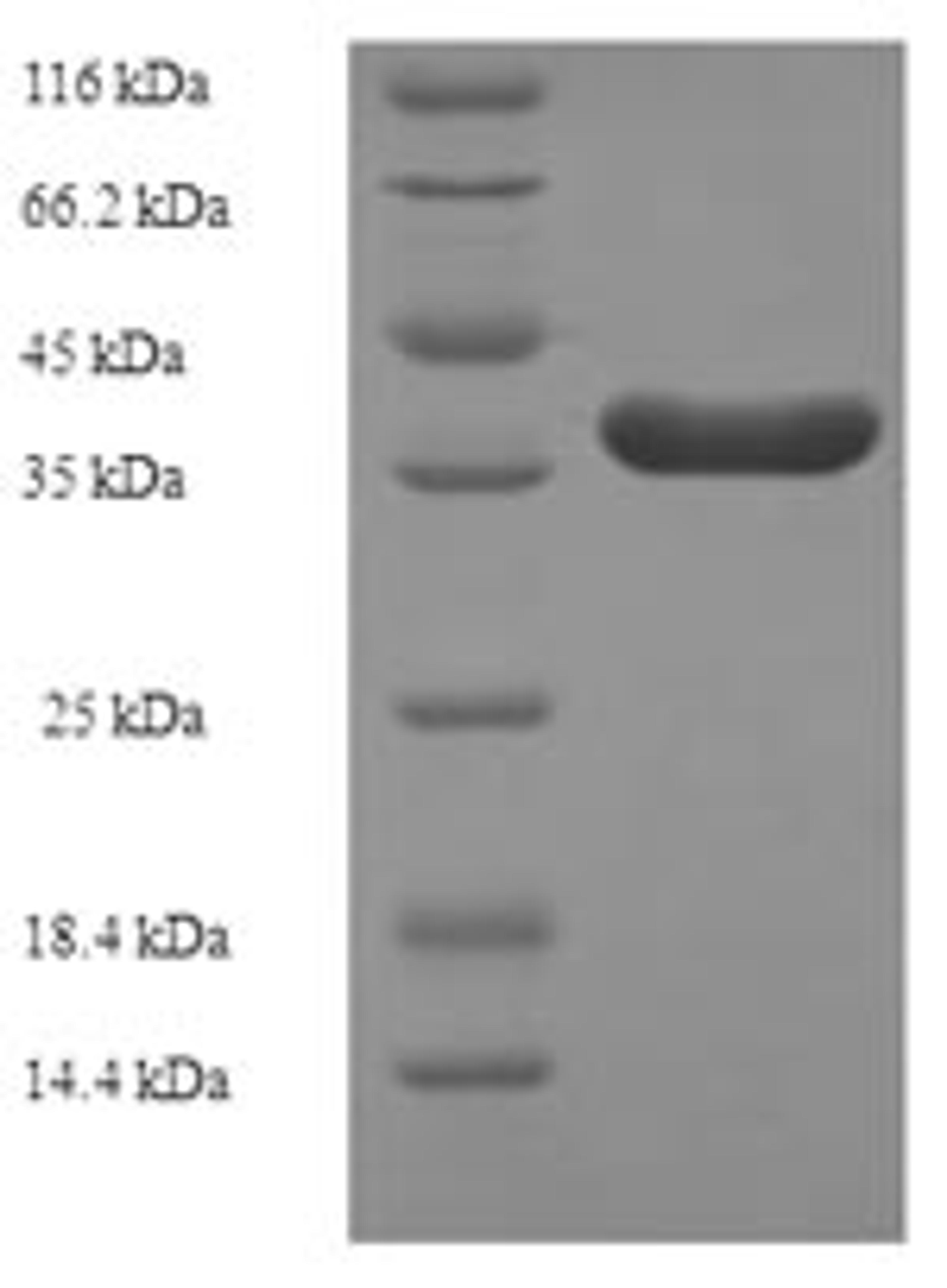(Tris-Glycine gel) Discontinuous SDS-PAGE (reduced) with 5% enrichment gel and 15% separation gel.